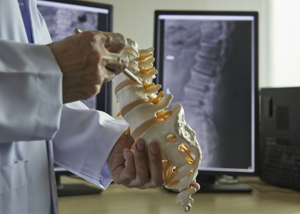 Back Surgery San Francisco
